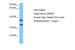 SIRP beta 1/CD172b Rabbit anti-Human, Polyclonal, Novus Biologicals 0.1ml;